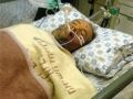 إصابة مقدسي بجروح ودخوله في غيبوبة بعد اعتداء مستوطنين عليه