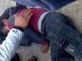 اصابة طفل جراء دهسه بسياره عموميه في بيت امر