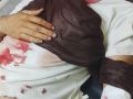 هجوم للمستوطنين على منازل عائلة شناران بوادي الرخيم يسفر عن 3 إصابات