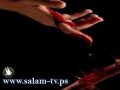 مقتل فتى طعنا بالسكين في شجار بمخيم قلنديا