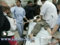 اصابة 42 مواطنا بقصف استهدف منزلا لقيادي في القسام بالقطاع