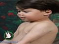 مواطن يهدد بالاعتصام أمام المقاطعة برام الله حتى تعالج الصحة طفله