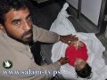 مأساة المخيمات... وسام وملَك يغرقان في بركة مجاري