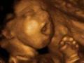 تقنية التصوير الرباعي الابعاد تظهر أجنة يتثاءبون داخل الرحم