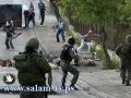 بينهم فتى بحالة خطيرة- 25 اصابة واعتقال 21 بمواجهات عنيفة باحياء القدس