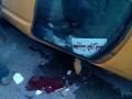 بالصور :اصابة مواطن من مدينة نابلس بحادث انقلاب سيارة عمومي