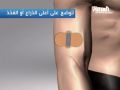 بالفيديو : لاصقة كهربائية لعلاج الصداع ومضاعفاته