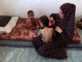 10 وفيات بينها 3 أطفال نتيجة التجويع في غزة خلال الساعات الماضية