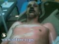 رئيس بلدة جزائرية لشاب عاطل: إحرق نفسك إن كنت تملك شجاعة بوعزيزي..فأحرق الشاب نفسه
