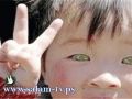(فيديو) طفل بعيون قط يحيّر الأطباء في الصين