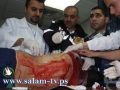 صباح اليوم : مستوطنين يعتدون بالضرب على شاب جنوب نابلس