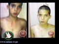 (بالصور) سعيد ذهب لشراء الحليب فعاد مثخنا بالجراح