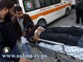 شهيد وجريحان بغارة على " توكتوك " شمال غزة