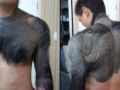 جسم رجل صيني كالقرود بسبب وحمه - صور