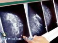 سرطان الثدي يصيب الرجال بشكل نادر ولكن بشراسة