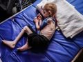 7 وفيات نتيجة التجويع في غزة خلال الساعات الماضية