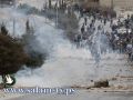 اصابة 10 مواطنين برصاص الاحتلال ومواجهات في سلوان