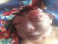 ولادة طفل غريب مبتور الرأس في اليمن - صوره