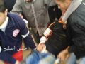 شهيد وعشرات الاصابات برصاص الاحتلال في غزه