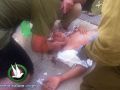 بالصور- مستوطن يدهس طفلا في مدينة الخليل