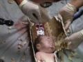 انقاذ رضيع من ماسورة مرحاض في الصين - شاهد الصور والفيديو