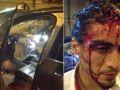 شاهد الصور : لاعب نادي يوفنتوس الايطالي الأورغوياني كاسيريس يتعرض لحادث سير مروع