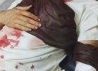 هجوم للمستوطنين على منازل عائلة شناران بوادي الرخيم يسفر عن 3 إصابات