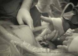 بالفيديو : مولودة تمسك يد الطبيب وتخرج من رحم والدتها