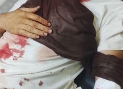 هجوم للمستوطنين على منازل عائلة شناران بوادي الرخيم يسفر عن 3 إصابات