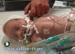في بريطانيا- طفل يولد بدون قطرة دم في جسمه
