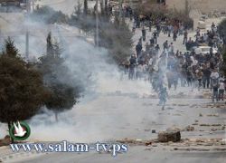 شاب من سلوان يفقد بصره نتيجة الغاز المسيل للدموع