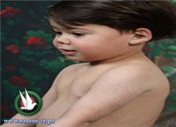 مواطن يهدد بالاعتصام أمام المقاطعة برام الله حتى تعالج الصحة طفله