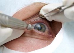 اكتشاف طريقة جديدة لعلاج إعتام عدسة العين