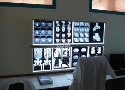 نقابة التصوير الطبي تعلن الاضراب المفتوح