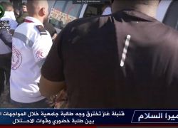 طولكرم: الاحتلال يصيب طالبة جامعية بقنبلة غاز في الوجه وآخرين بالرصاص خلال مواجهات .. فيديو