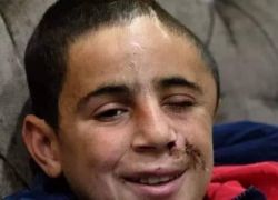 قوات الاحتلال تعتقل الطفل الجريح &quot;محمد التميمي &quot; من منزله في قرية النبي صالح