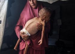 5 وفيات نتيجة المجاعة وسوء التغذية خلال الـ24 ساعة الماضية