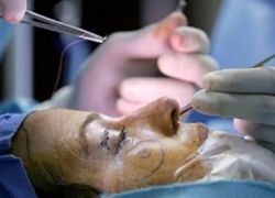 إعادة بناء وجوه الناس من دهونهم