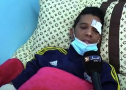 شاهد ..معلم يفقد بصره بعينه اليمنى جراء تعرضه للضرب على يد تلميذه السابق