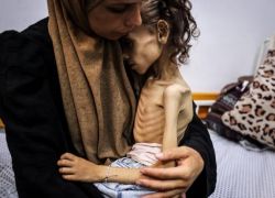 5 حالات وفاة جديدة نتيجة المجاعة وسوء التغذية في قطاع غزة