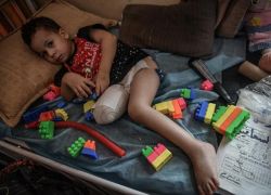 42 ألف إصابة مُعطِّلة للحياة في غزة: رقم يكشف حجم الكارثة الصامتة