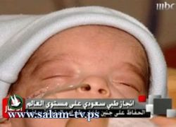 ولادة طفل سعودي قضى 4 أشهر في أحشاء أمه المتوفاة