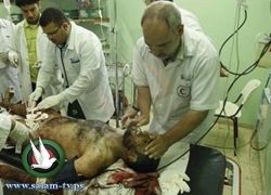 16 شهداء ونحو 73 جريحا في أكثر من 40 غارة خلال أسبوع
