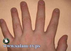 سوري يدخل موسوعة "غينيس" على أصابعه!!