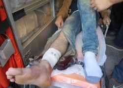 إصابات خلال مواجهات مع الاحتلال في بلدة قباطية جنوب جنين