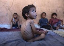 خلال يوم.. 5 حالات وفاة نتيجة سوء التغذية في قطاع غزة