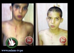 (بالصور) سعيد ذهب لشراء الحليب فعاد مثخنا بالجراح
