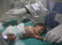 وفاة رضيع مريض هو الثالث في أقل من 24 ساعة في غزة