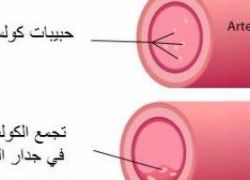 اكتشاف عقار جديد يؤدى إلى انخفاض الكولسترول فى الجسم