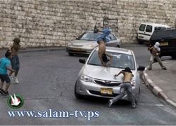 اصابة طفل بجراح حرجة جراء تعرضه للدهس من قبل مستوطن جنوب نابلس